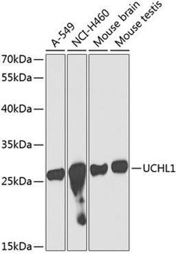 Western blot - UCHL1 antibody (A2131)