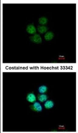 Immunocytochemistry/Immunofluorescence: ZNF587 Antibody [NBP2-21030] - Immunofluorescence analysis of paraformaldehyde-fixed A431, using antibody at 1:500 dilution.