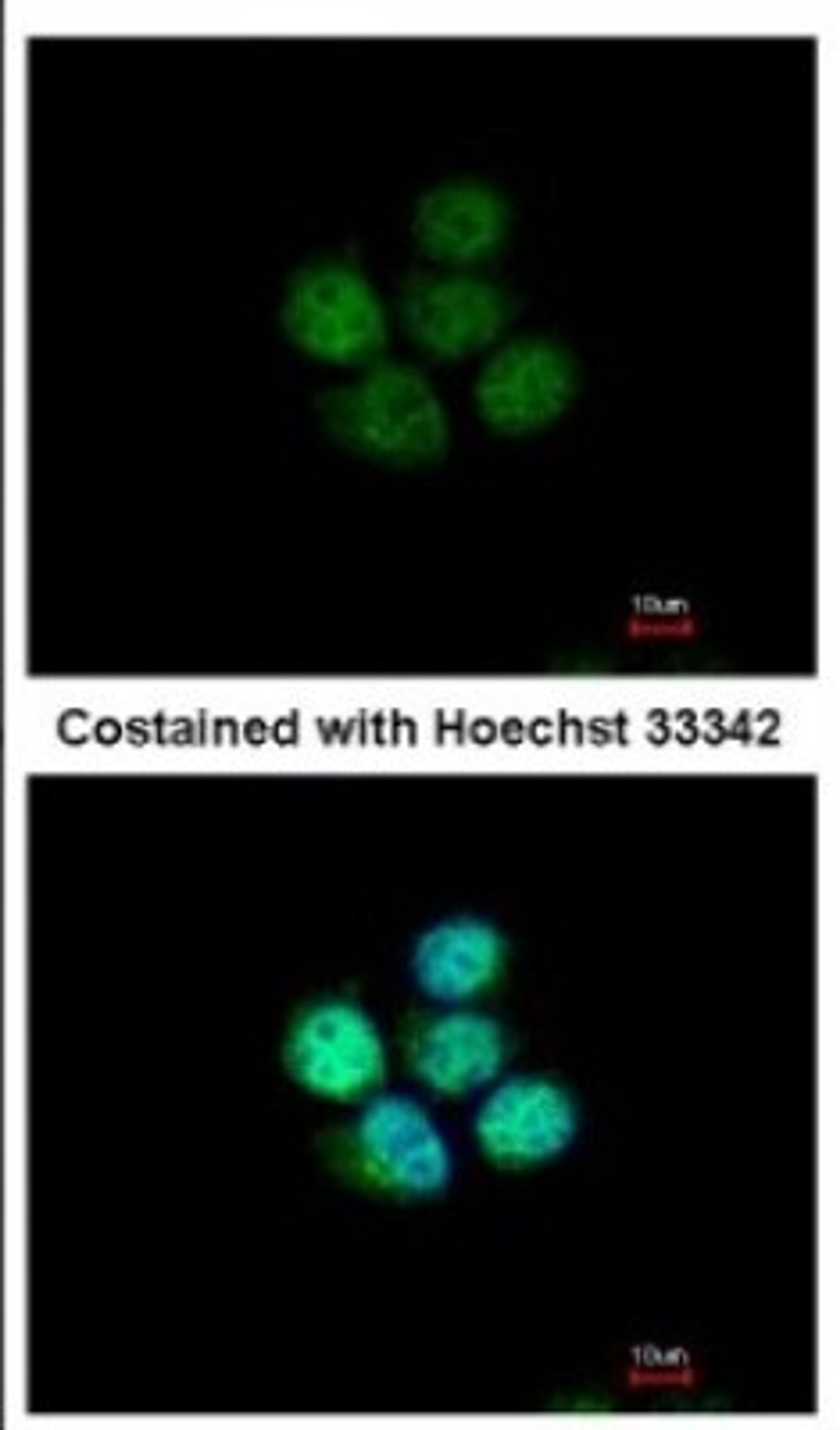 Immunocytochemistry/Immunofluorescence: ZNF587 Antibody [NBP2-21030] - Immunofluorescence analysis of paraformaldehyde-fixed A431, using antibody at 1:500 dilution.