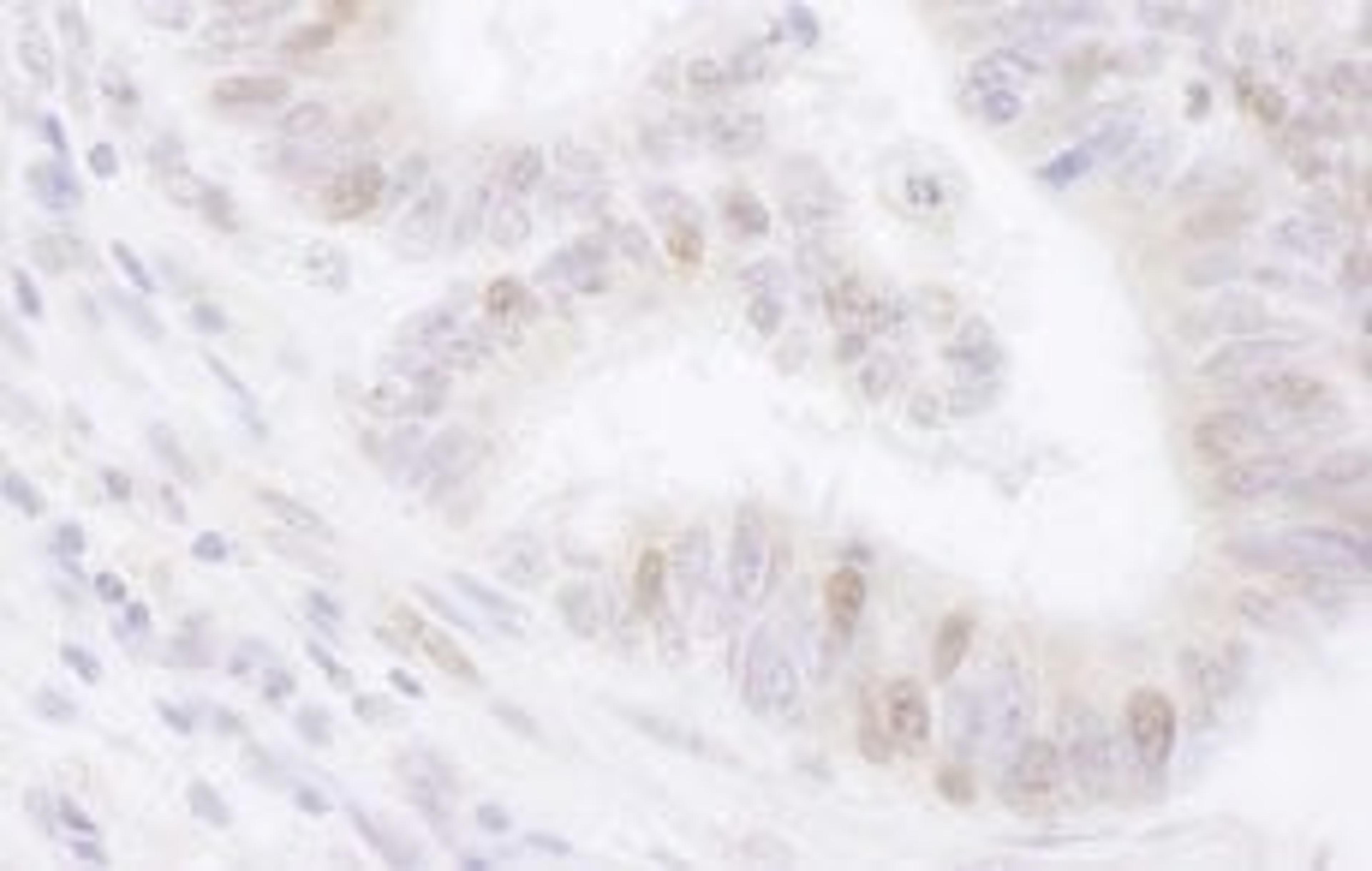 Detection of human PAF by immunohistochemistry.