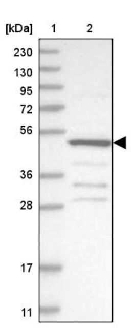 Western Blot: SCP2 Antibody [NBP1-85958] - Lane 1: Marker [kDa] 230, 130, 95, 72, 56, 36, 28, 17, 11<br/>Lane 2: Human cell line RT-4