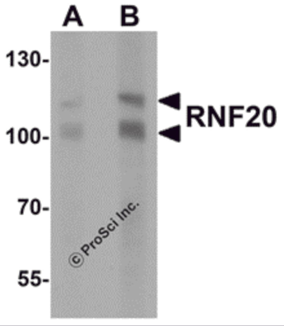 Western blot analysis of RNF20 in human liver tissue lysate with RNF20 antibody at (A) 1 and (B) 2 μg/mL.