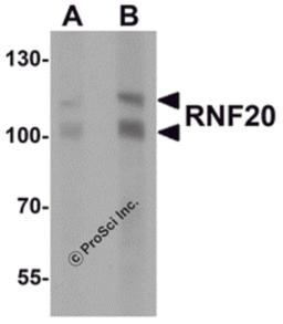 Western blot analysis of RNF20 in human liver tissue lysate with RNF20 antibody at (A) 1 and (B) 2 μg/mL.