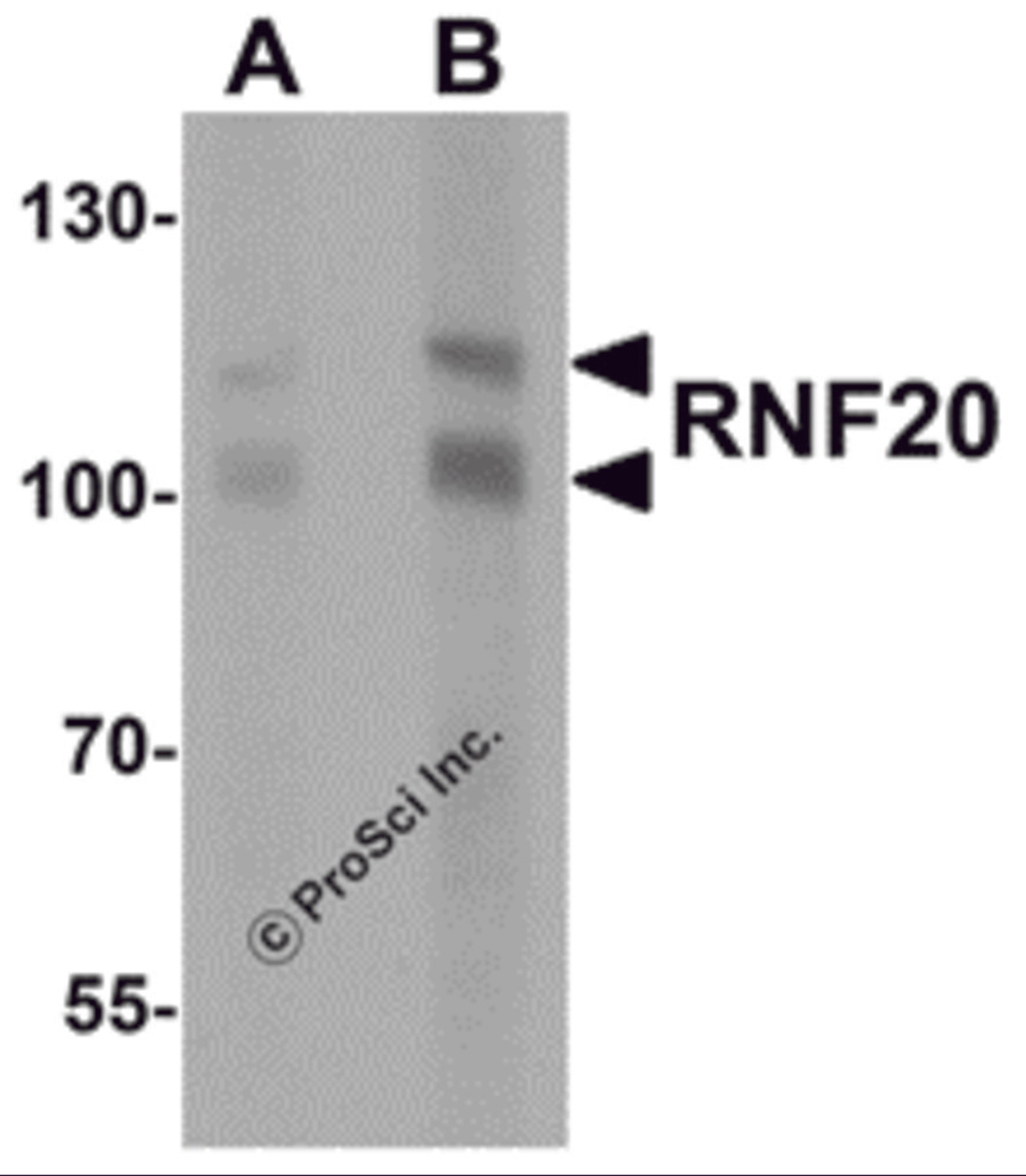 Western blot analysis of RNF20 in human liver tissue lysate with RNF20 antibody at (A) 1 and (B) 2 μg/mL.
