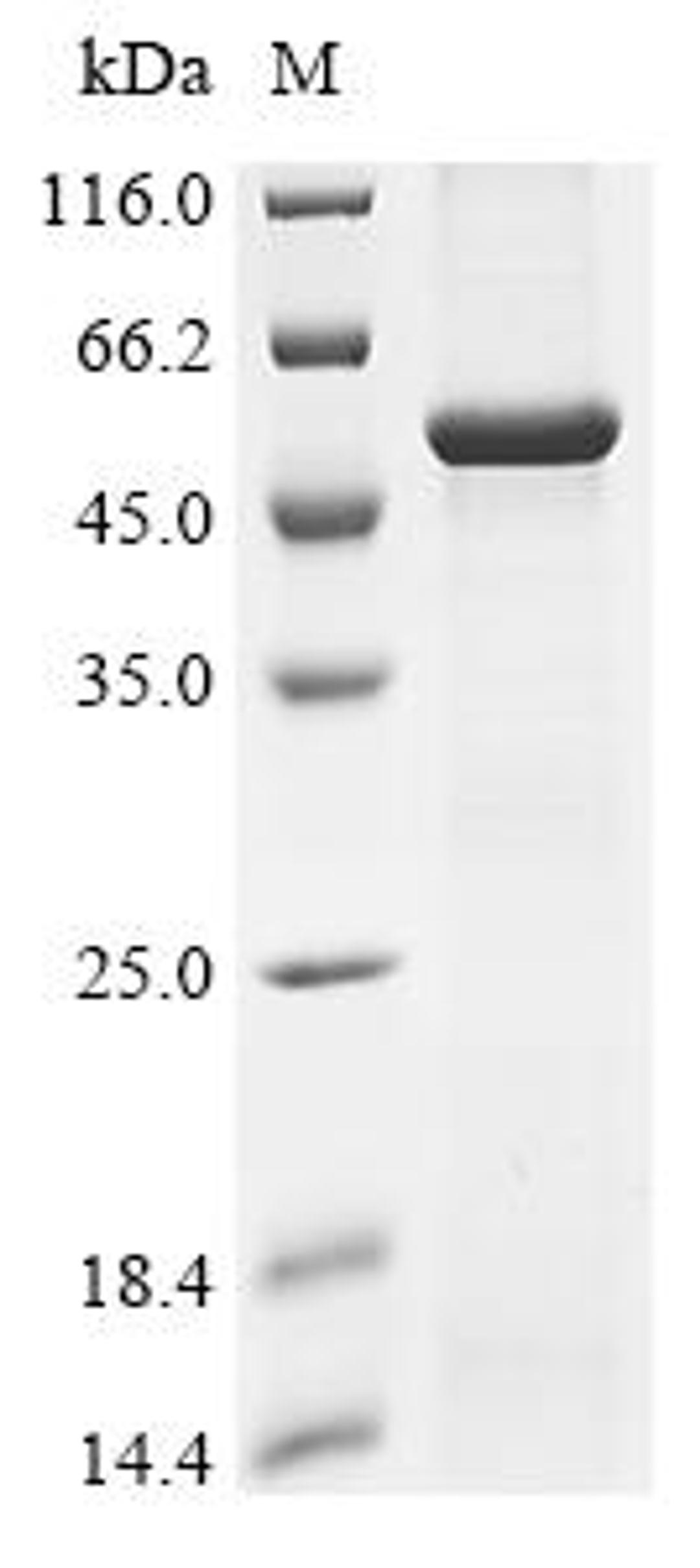 (Tris-Glycine gel) Discontinuous SDS-PAGE (reduced) with 5% enrichment gel and 15% separation gel.