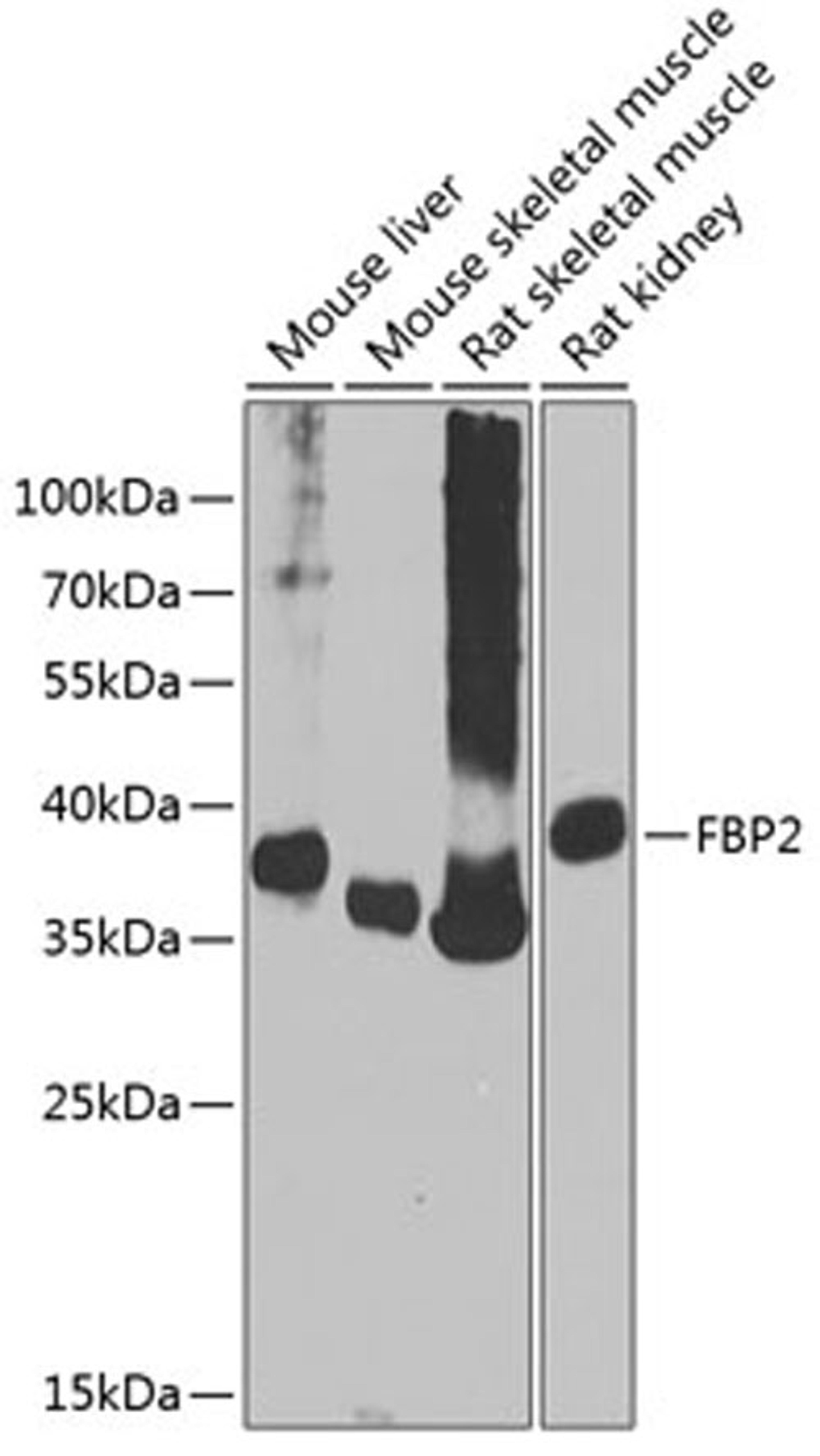 Western blot - FBP2 antibody (A9850)