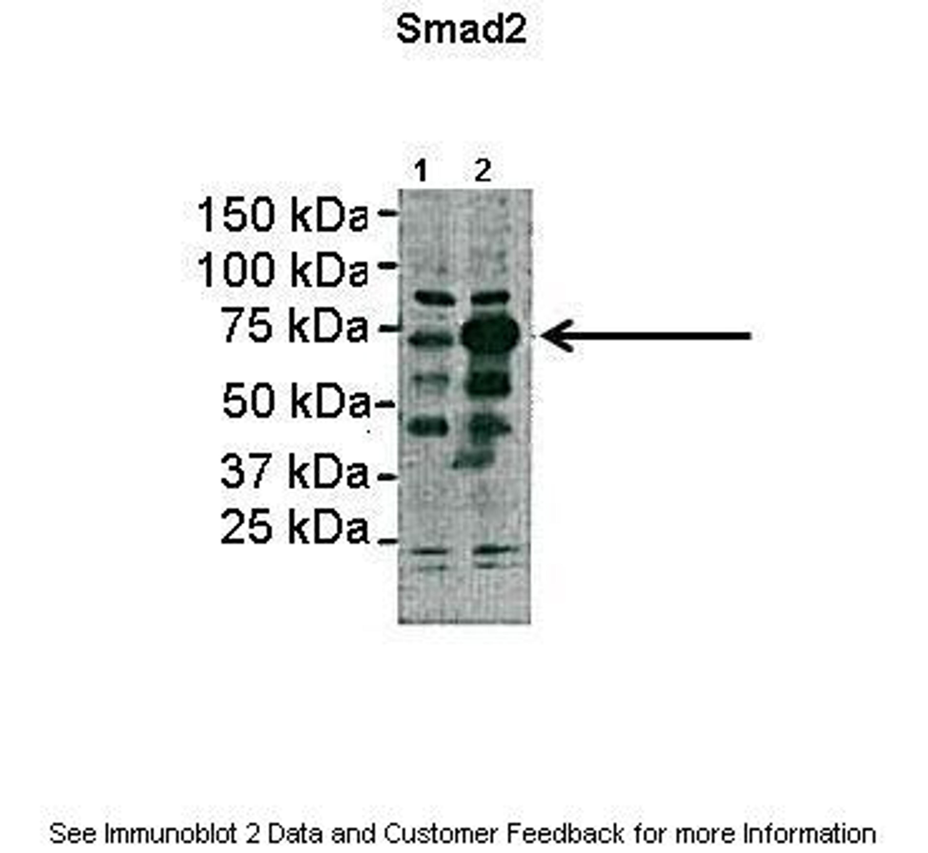 Antibody used in WB on transfected HEK-293 at: 1:1000 (Lane1: 2ug HEK293lysate, Lane2: 2ug SMAD2 transfected HEK293 lysate).