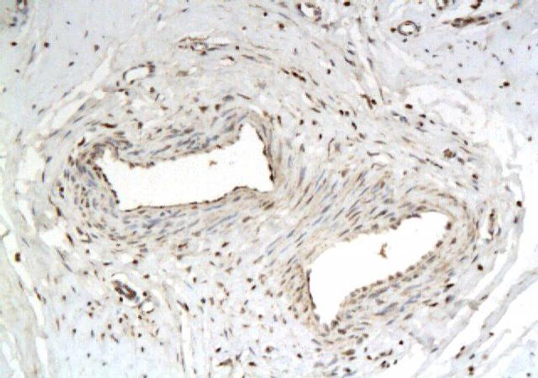 Immunohistochemical analysis of paraffin-embedded human tissue affected by keloid using P311 antibody