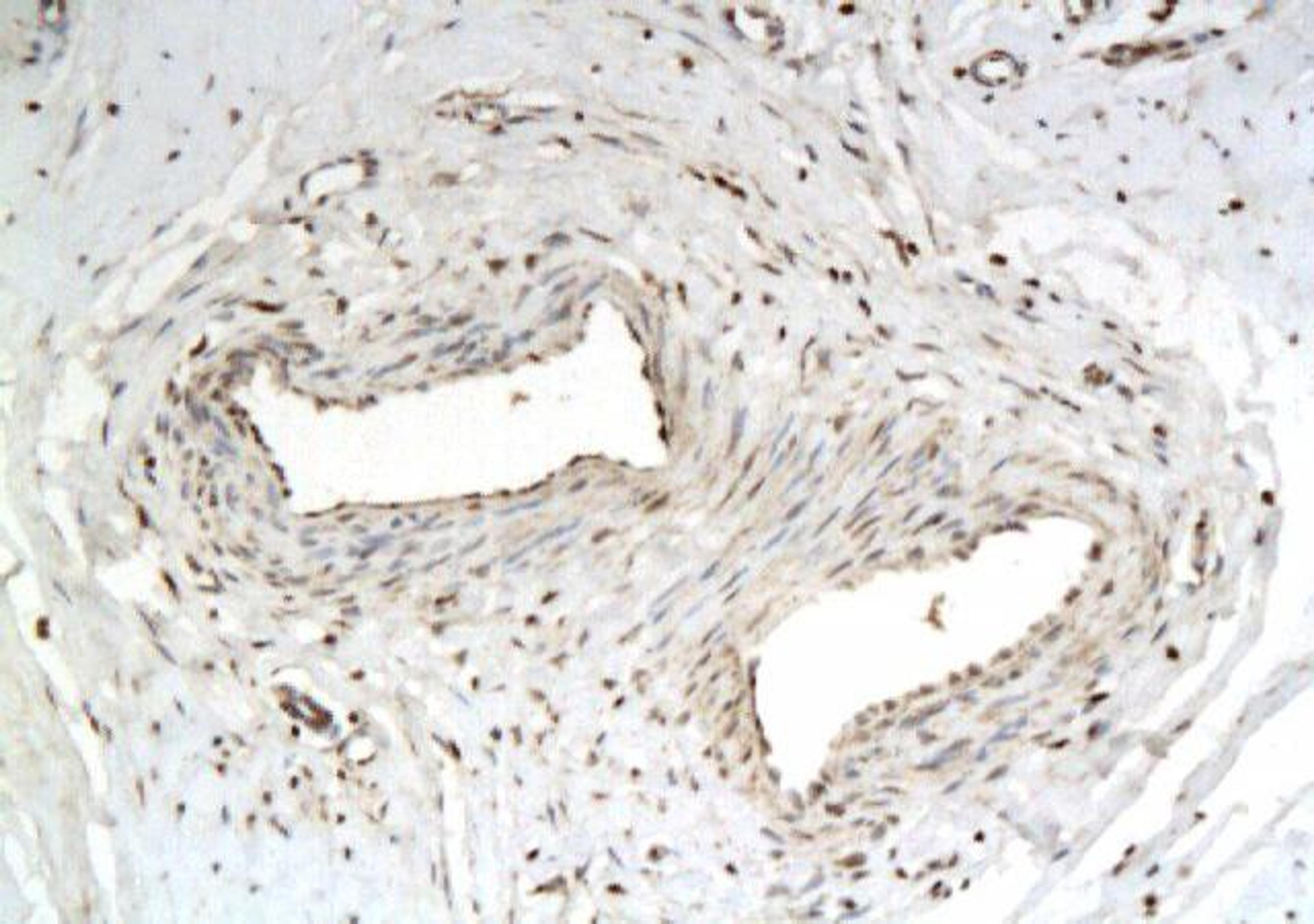 Immunohistochemical analysis of paraffin-embedded human tissue affected by keloid using P311 antibody