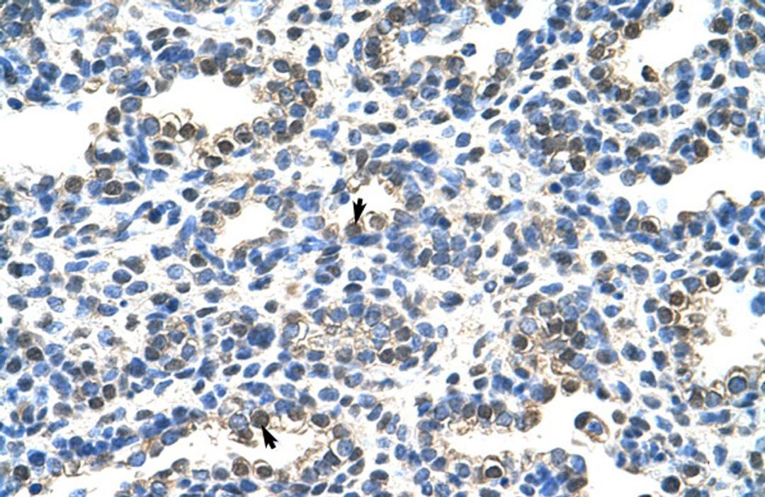 Antibody used in IHC on Human Lung at 4.0-8.0 ug/ml.