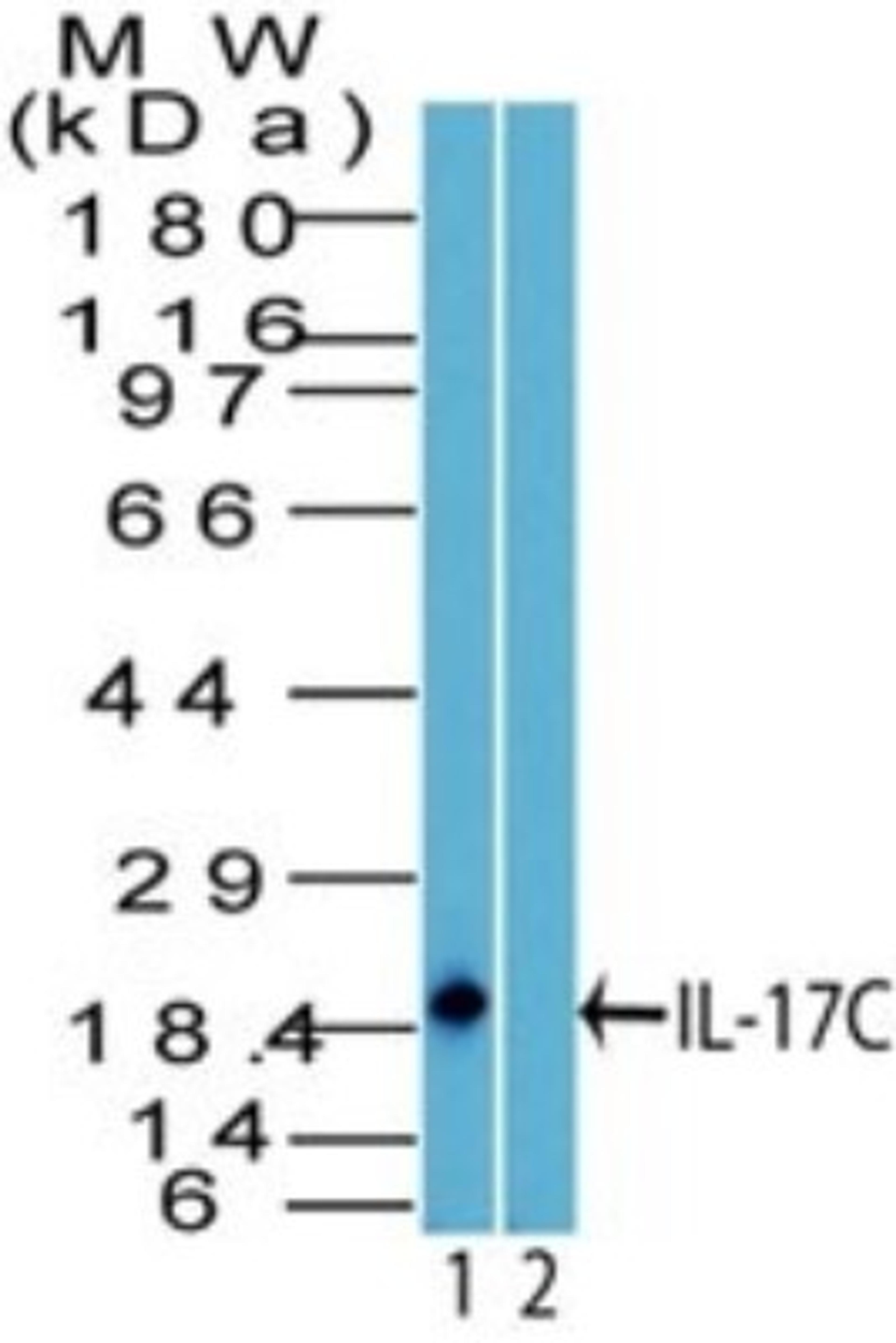 Western Blot: IL17C Antibody [NBP2-27100] - Analysis of IL-17C using IL17C antibody. THP1 cell lysate in the 1) absence and 2) presence of immunizing peptide probed with 2 ug/ml of IL17C antibody. Goat anti-rabbit Ig HRP secondary antibody and PicoTect ECL substrate solution were used for this test.