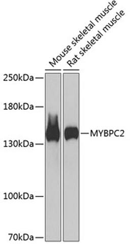 Western blot - MYBPC2 antibody (A13331)