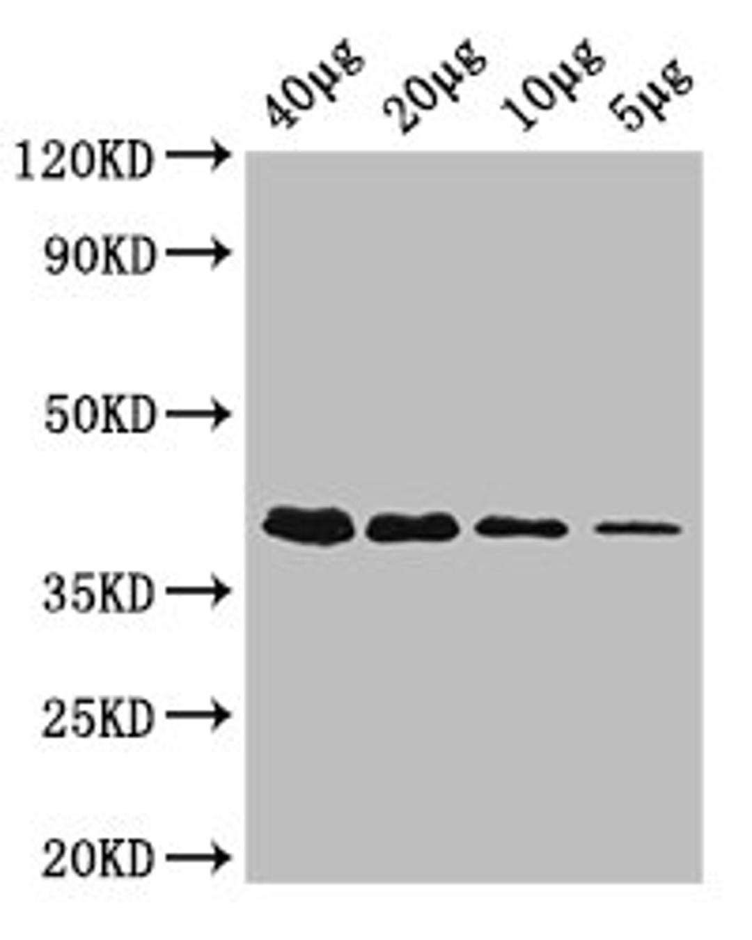 Western Blot. Positive WB detected in: Rosseta bacteria lysate at 40µg, 20µg, 10µg, 5µg. All lanes: rbsK antibody; HRP conjugated at 0.42µg/ml. Predicted band size: 33 kDa. Observed band size: 40 kDa