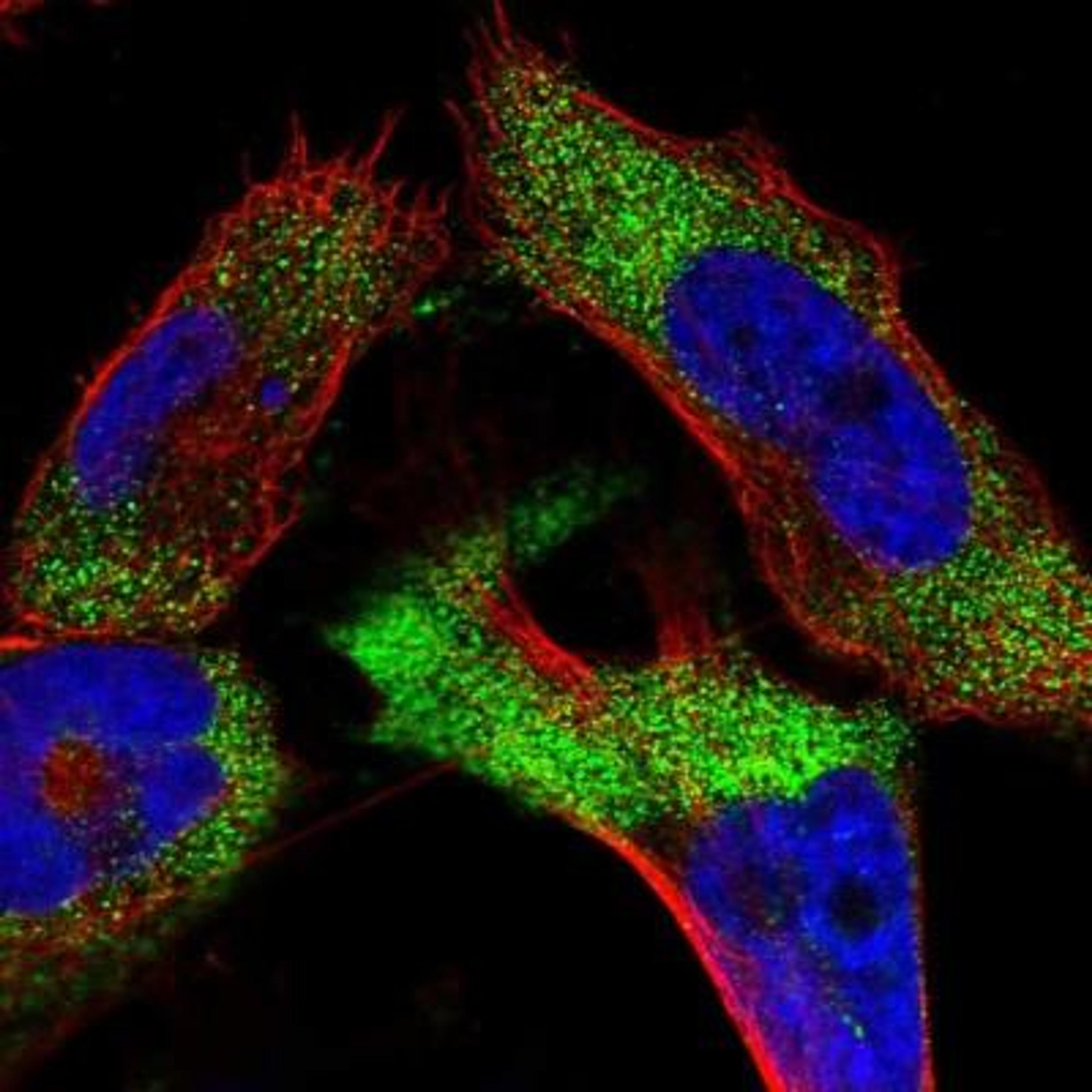 Immunocytochemistry/Immunofluorescence: NOTO Antibody [NBP1-91009] - Staining of human cell line U-251MG shows positivity in cytoplasm.