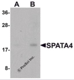 Western blot analysis of SPATA4 in mouse stomach tissue lysate with SPATA4 antibody at (A) 1 and (B) 2 &#956;g/mL.