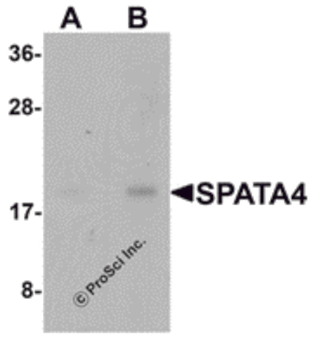 Western blot analysis of SPATA4 in mouse stomach tissue lysate with SPATA4 antibody at (A) 1 and (B) 2 μg/mL.