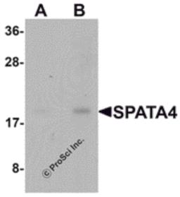 Western blot analysis of SPATA4 in mouse stomach tissue lysate with SPATA4 antibody at (A) 1 and (B) 2 μg/mL.