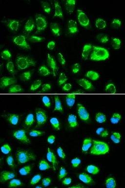 Confocal immunofluoroscence analysis of Hela cells using GAS2 antibody.