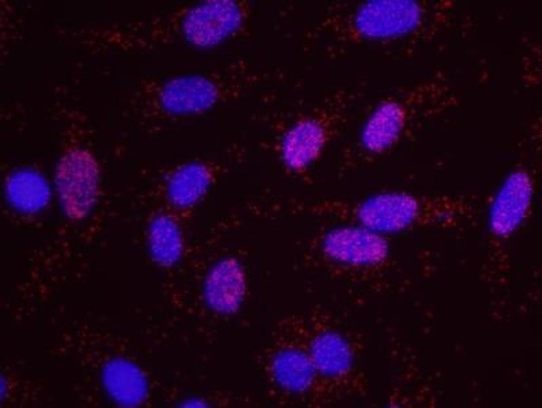 Proximity Ligation Assay: CBP/KAT3A Antibody [NB100-381] - Secondary-conjugate Duolink II PLA in Hela cells. goat anti-human ATM (NB100-271) and rabbit anti-human CBP (NB100-381). Image merged from DAPI (2ms) and Texs Red (200ms) exposures, 40X magnification.