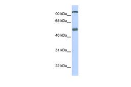 Antibody used in WB on Human Lung at 0.2-1 ug/ml.