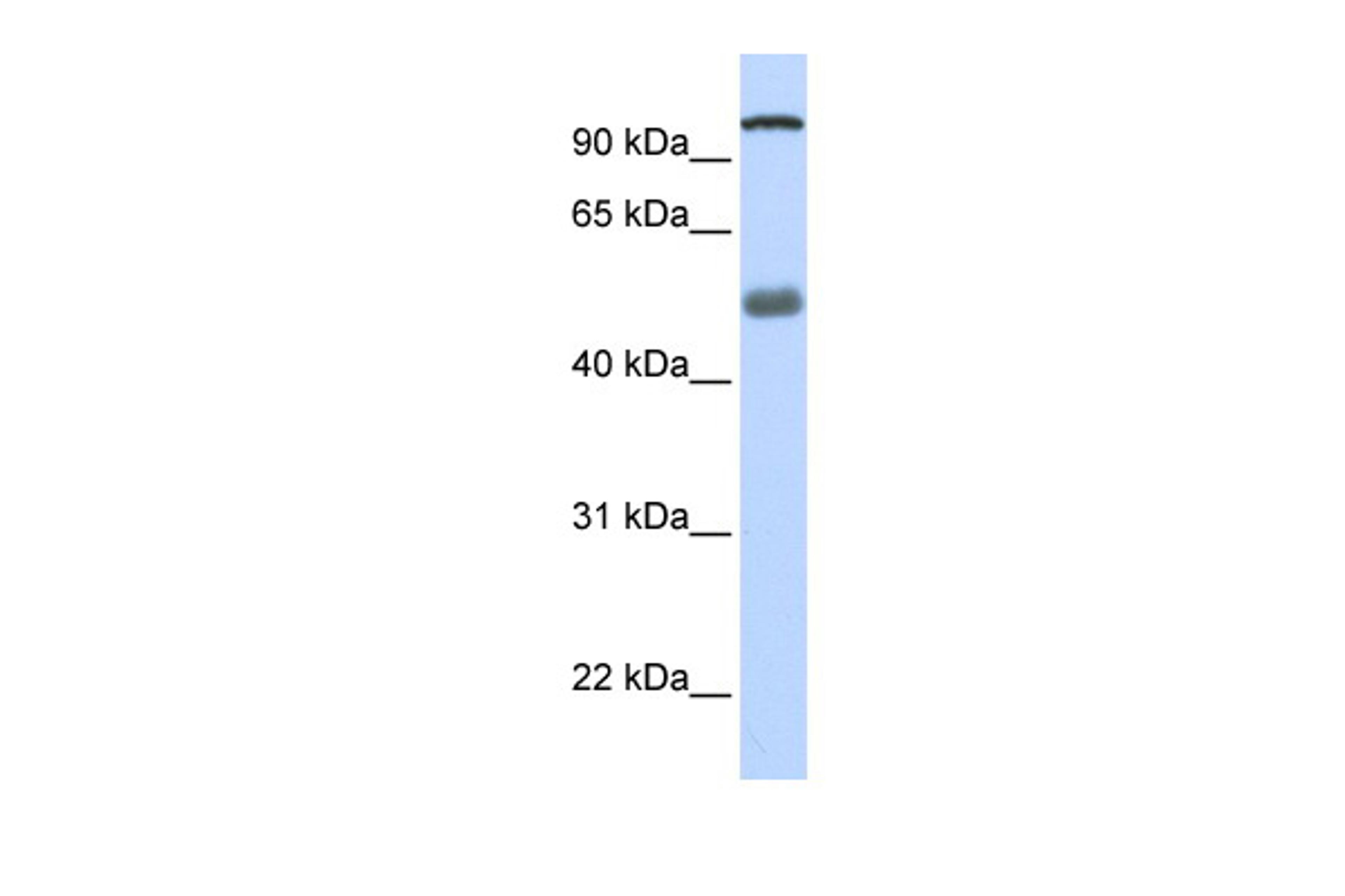 Antibody used in WB on Human Lung at 0.2-1 ug/ml.