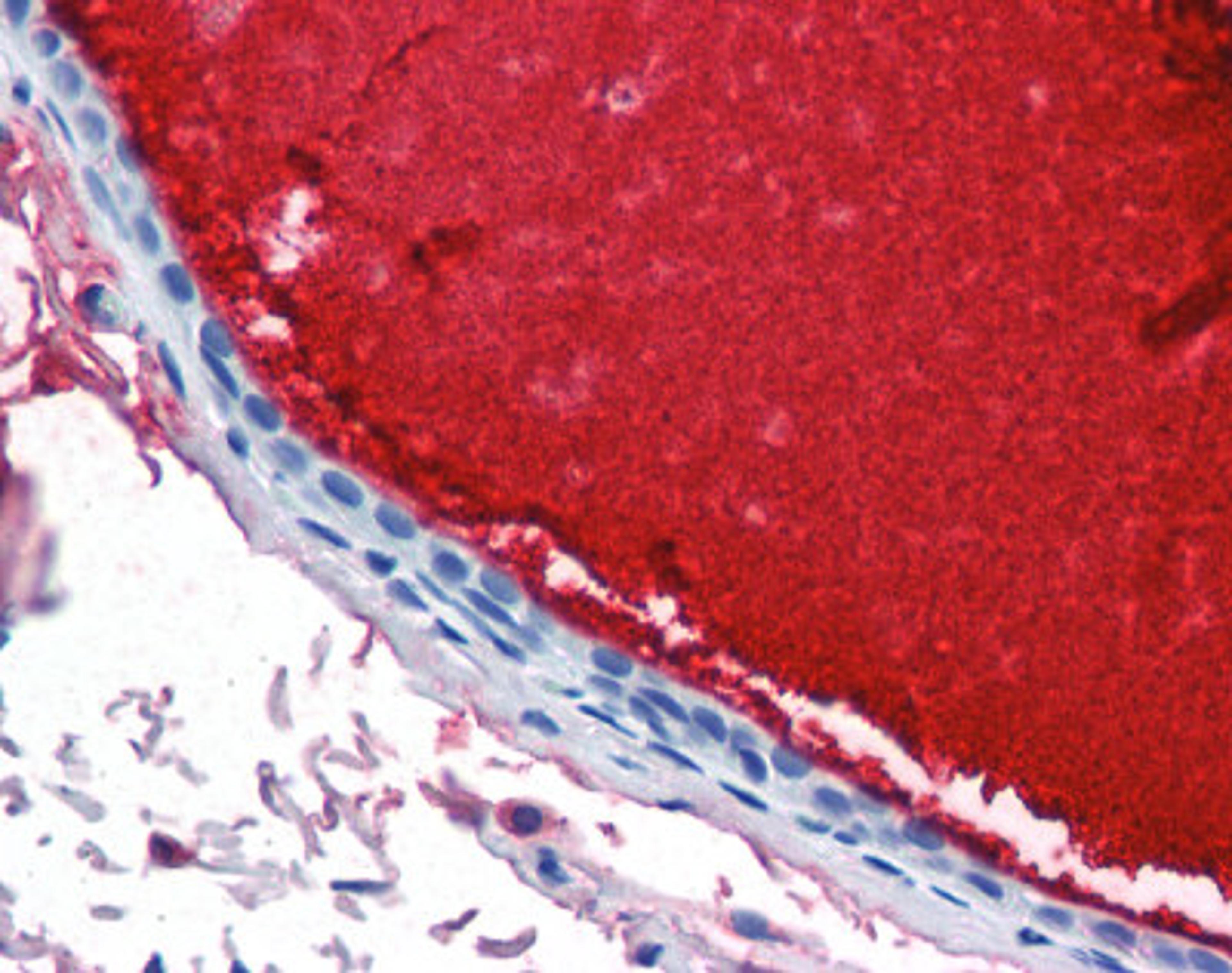 Immunohistochemistry staining of Lactotransferrin in breast, ductal with secretion tissue using Lactotransferrin monoclonal Antibody.