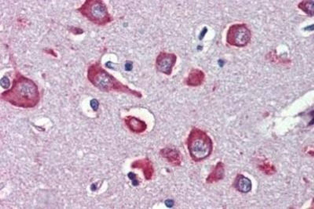 Immunohistochemistry-Paraffin: Nicotinic Acetylcholine R alpha 7/CHRNA7 Antibody [NBP1-52375] - Analysis of anti-CHRNA7 antibody with human brain, cortex at concentration 3 ug/ml.