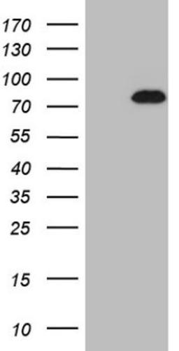 Western Blot: NOBOX Antibody (4C5) [NBP2-46193] - Analysis of HEK293T cells were transfected with the pCMV6-ENTRY control (Left lane) or pCMV6-ENTRY NOBOX.