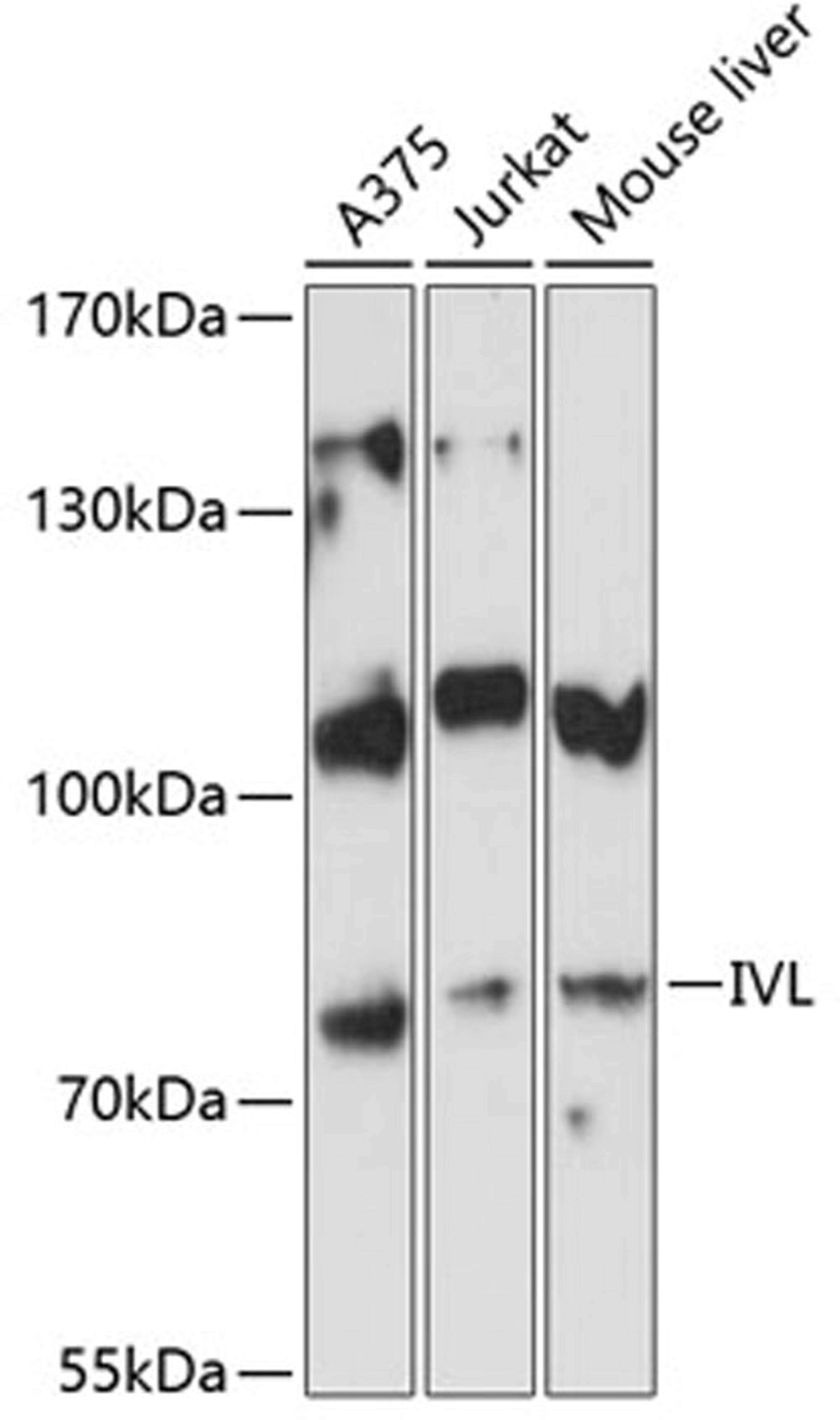 Western blot - IVL antibody (A8026)