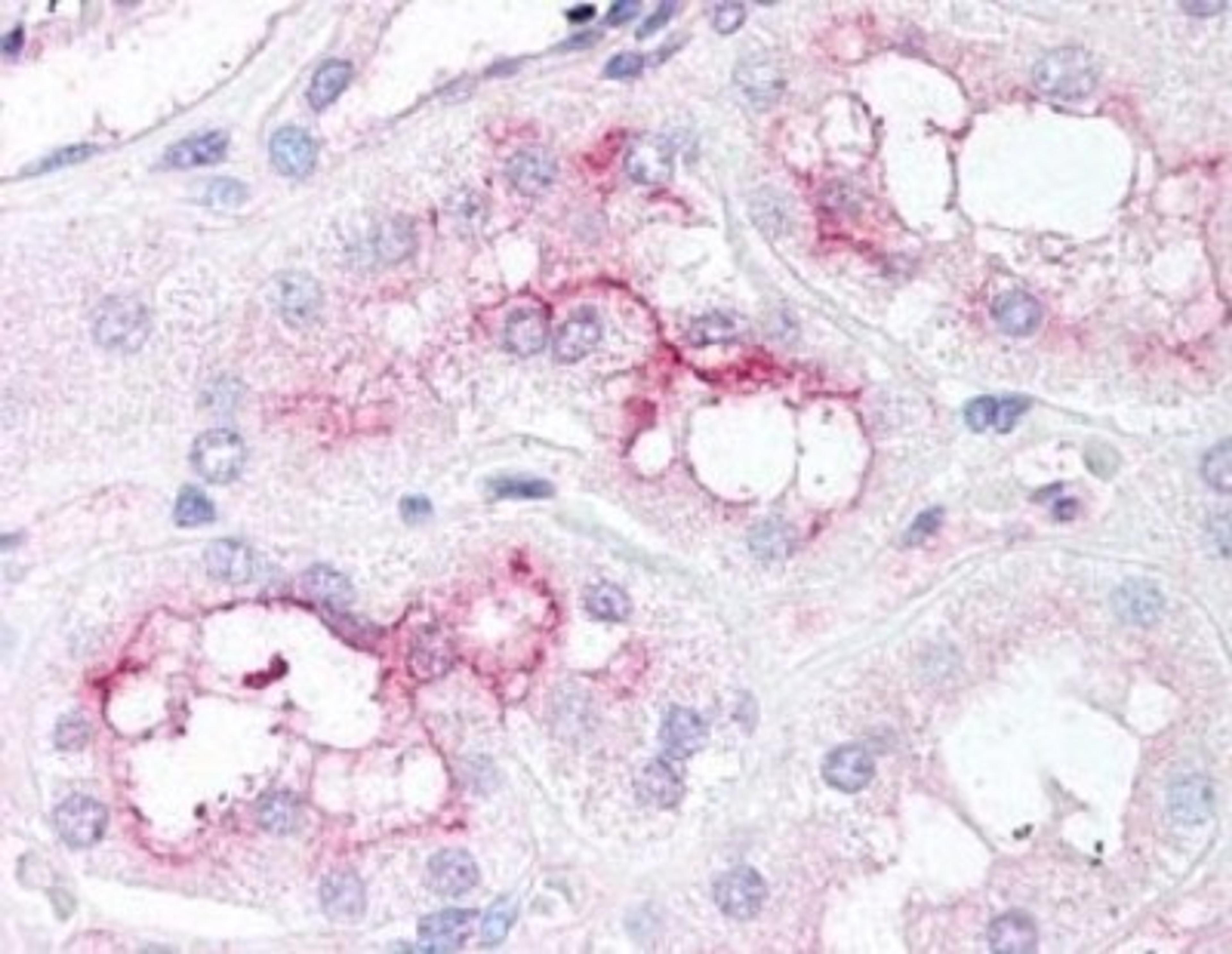 Immunohistochemistry-Paraffin: TOR/mTOR [p Ser2448] Antibody [NB600-607] - Immunohistochemistry. Affinity purified anti-mTOR pS2448 antibody was used at 5 ug/ml to detect signal in a variety of tissues including multi-human, multi-brain and multi-cancer slides. This image shows moderate staining of proximal convoluted tubules of the kidney. Tissue was formalin fixed and paraffin embedded. The image shows localization of the antibody as the precipitated red signal, with a hematoxylin purple nuclear counterstain.