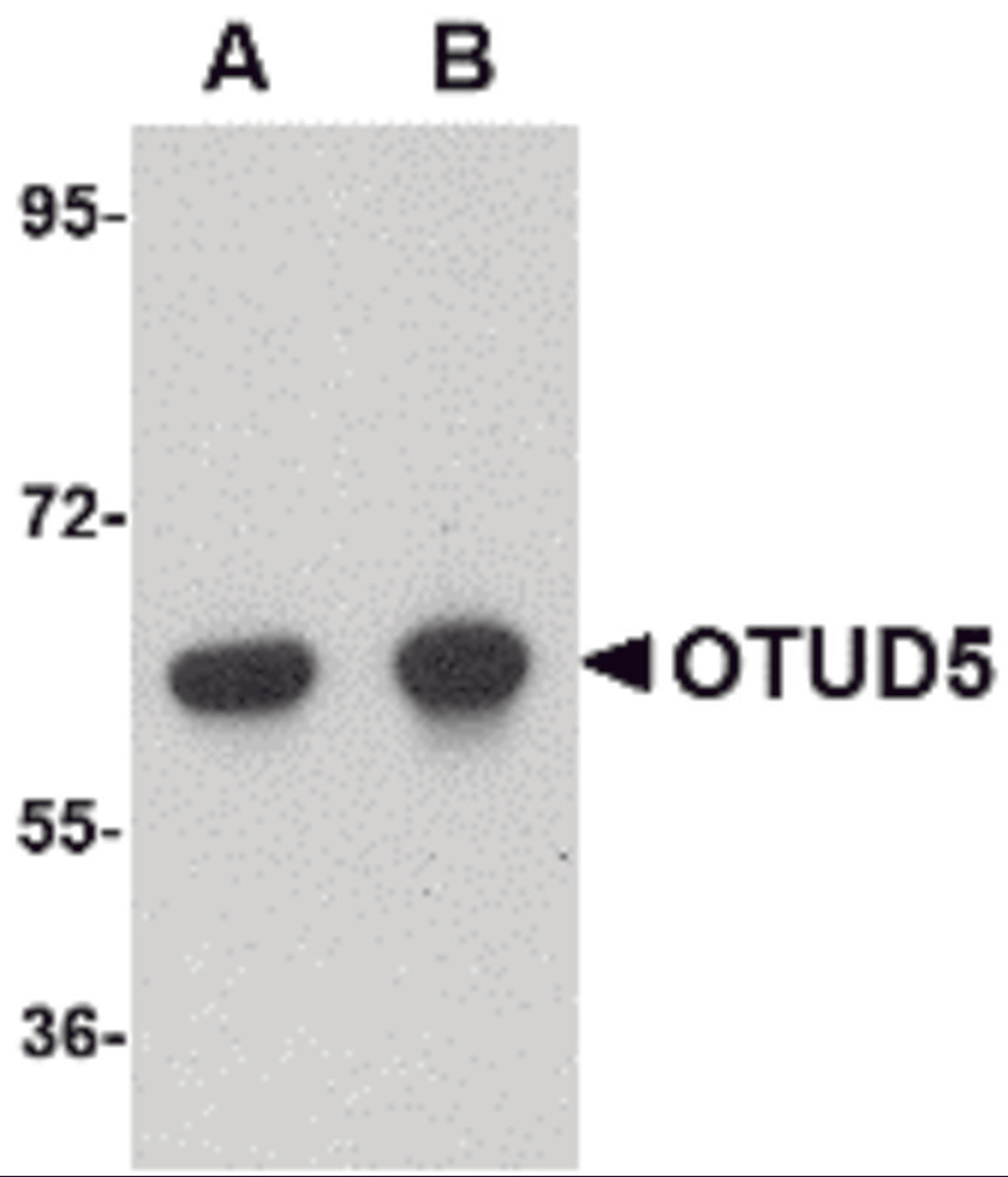 Western blot analysis of OTUD5 in human kidney lysate with OTUD5 antibody at (A) 1 and (B) 2 &#956;g/mL. 