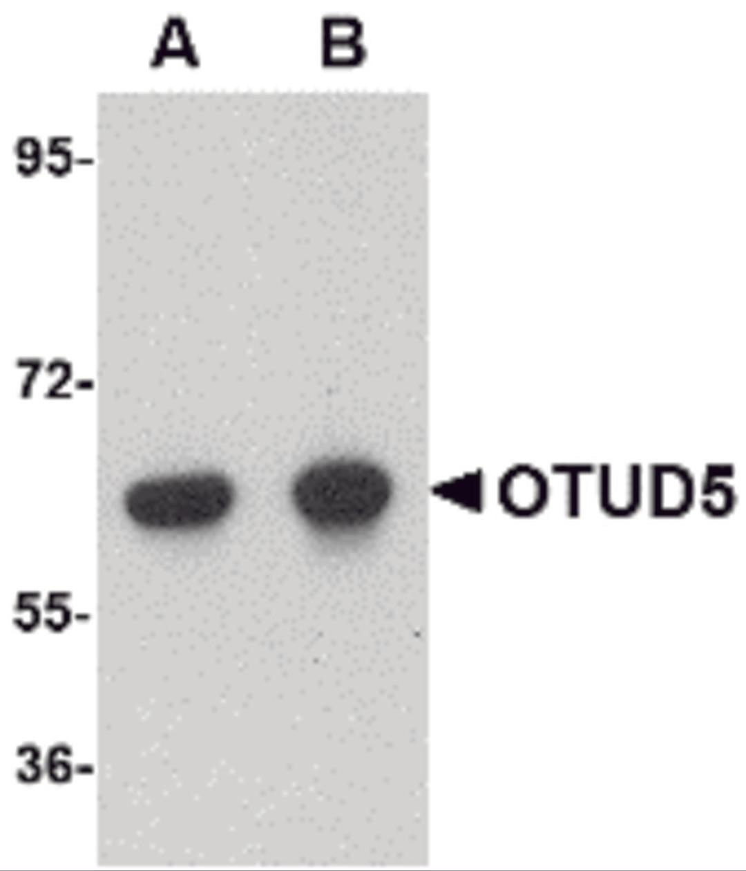 Western blot analysis of OTUD5 in human kidney lysate with OTUD5 antibody at (A) 1 and (B) 2 μg/mL.