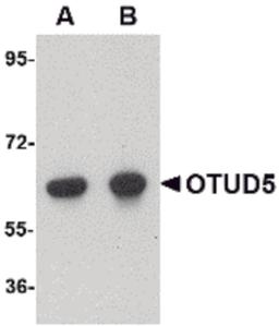 Western blot analysis of OTUD5 in human kidney lysate with OTUD5 antibody at (A) 1 and (B) 2 μg/mL.