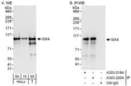 Detection of human SIX4 by western blot and immunoprecipitation.