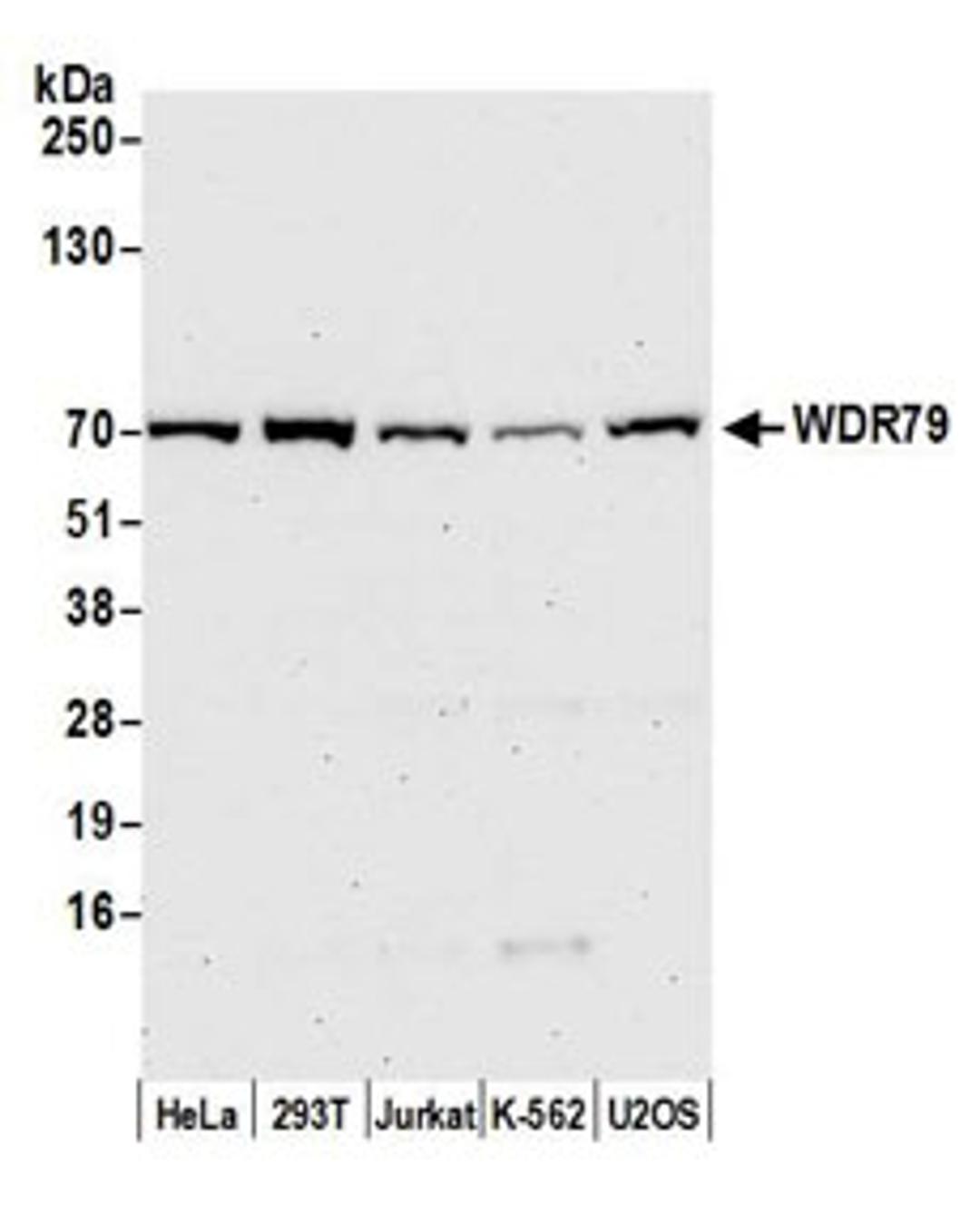 Detection of human WDR79 by western blot.