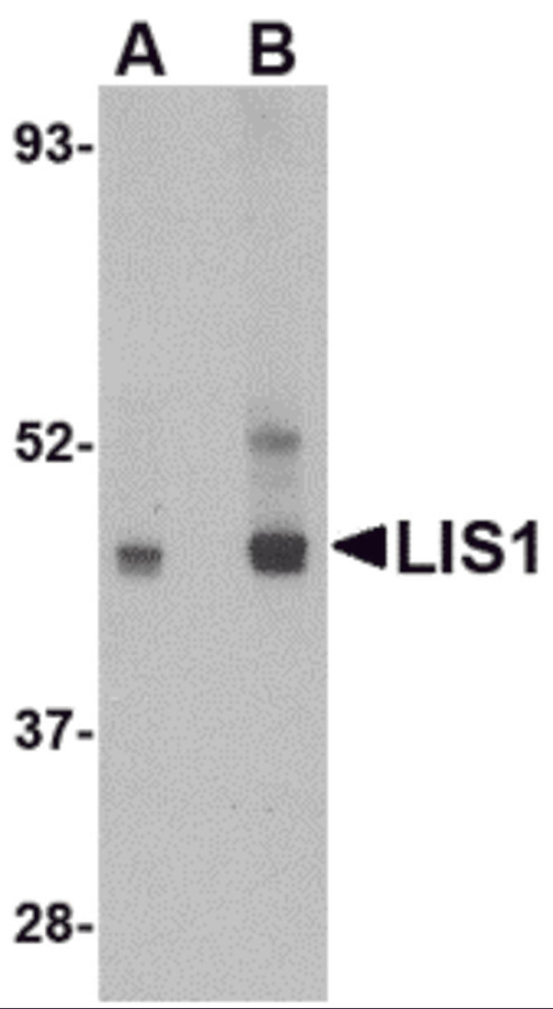 Western blot analysis of LIS1 in HeLa cell lysate with LIS1 antibody at (A) 0.5 and (B) 1 &#956;g/mL.