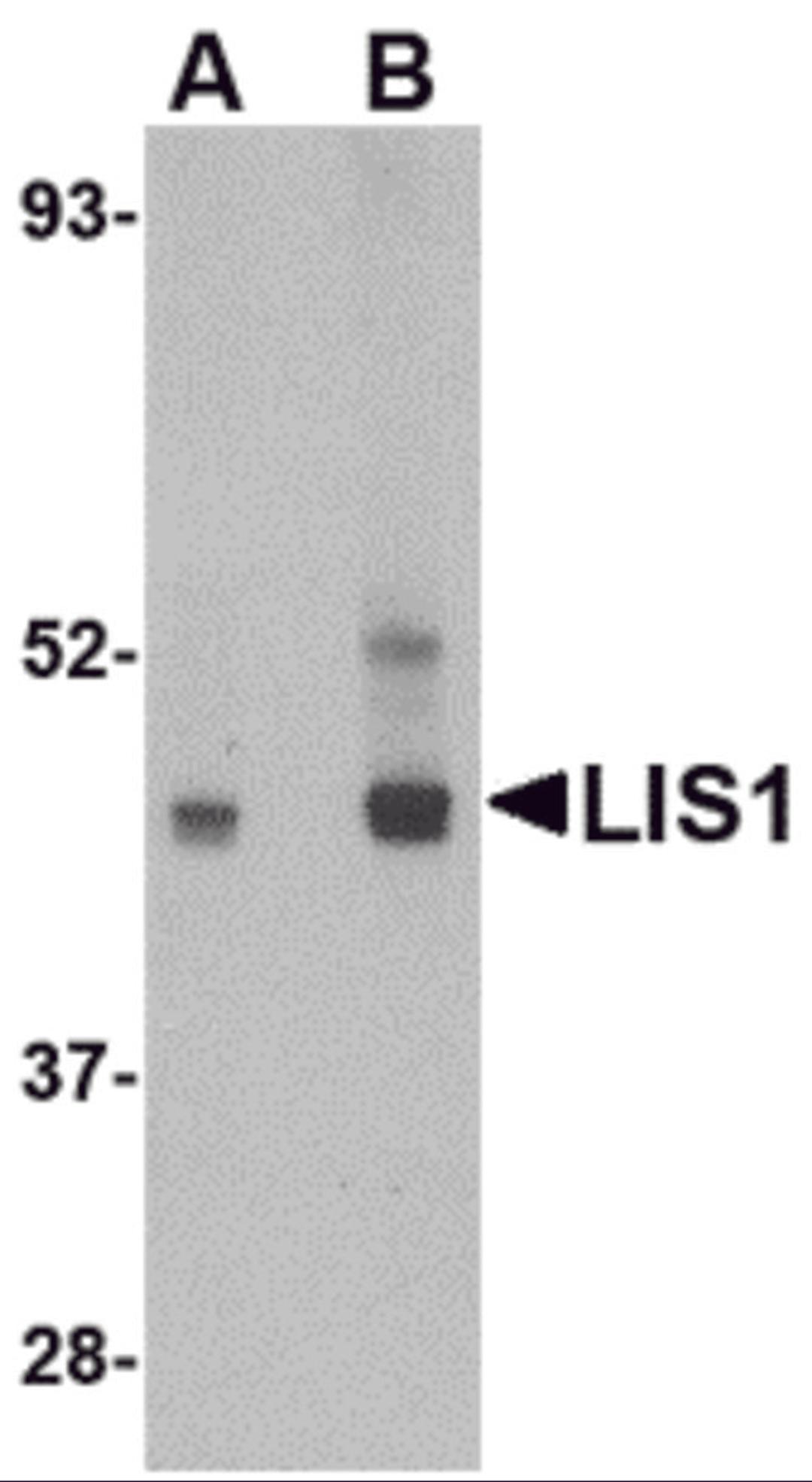 Western blot analysis of LIS1 in HeLa cell lysate with LIS1 antibody at (A) 0.5 and (B) 1 μg/mL.