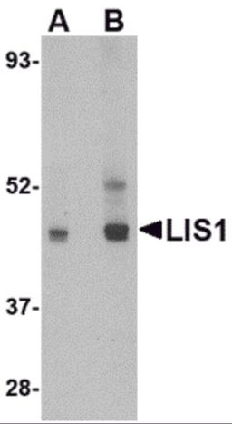 Western blot analysis of LIS1 in HeLa cell lysate with LIS1 antibody at (A) 0.5 and (B) 1 μg/mL.