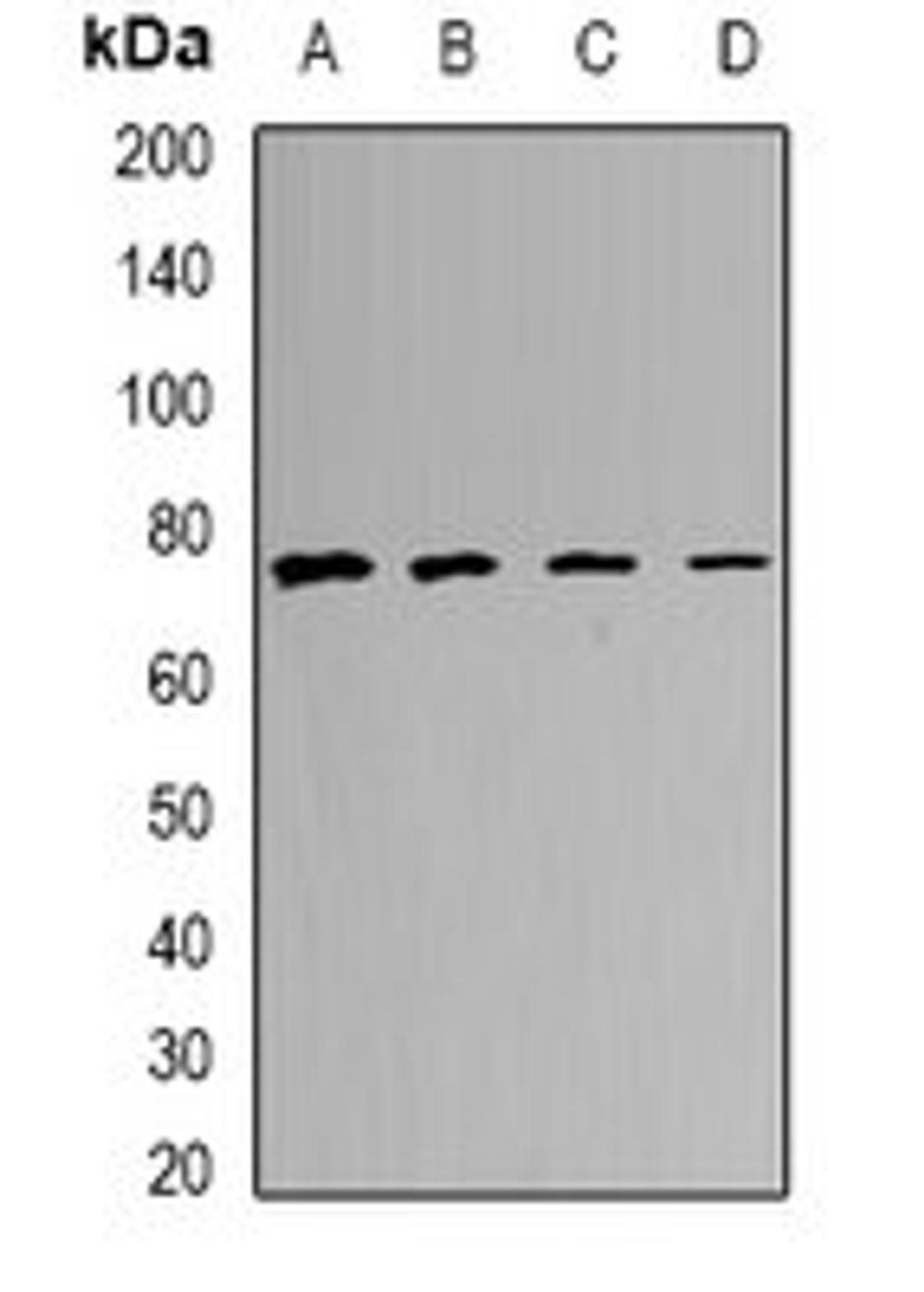 Western blot analysis of MCF7 (Lane1), A549 (Lane2), mouse lung (Lane3), mouse heart (Lane4) whole cell lysates using CALCOCO1 antibody