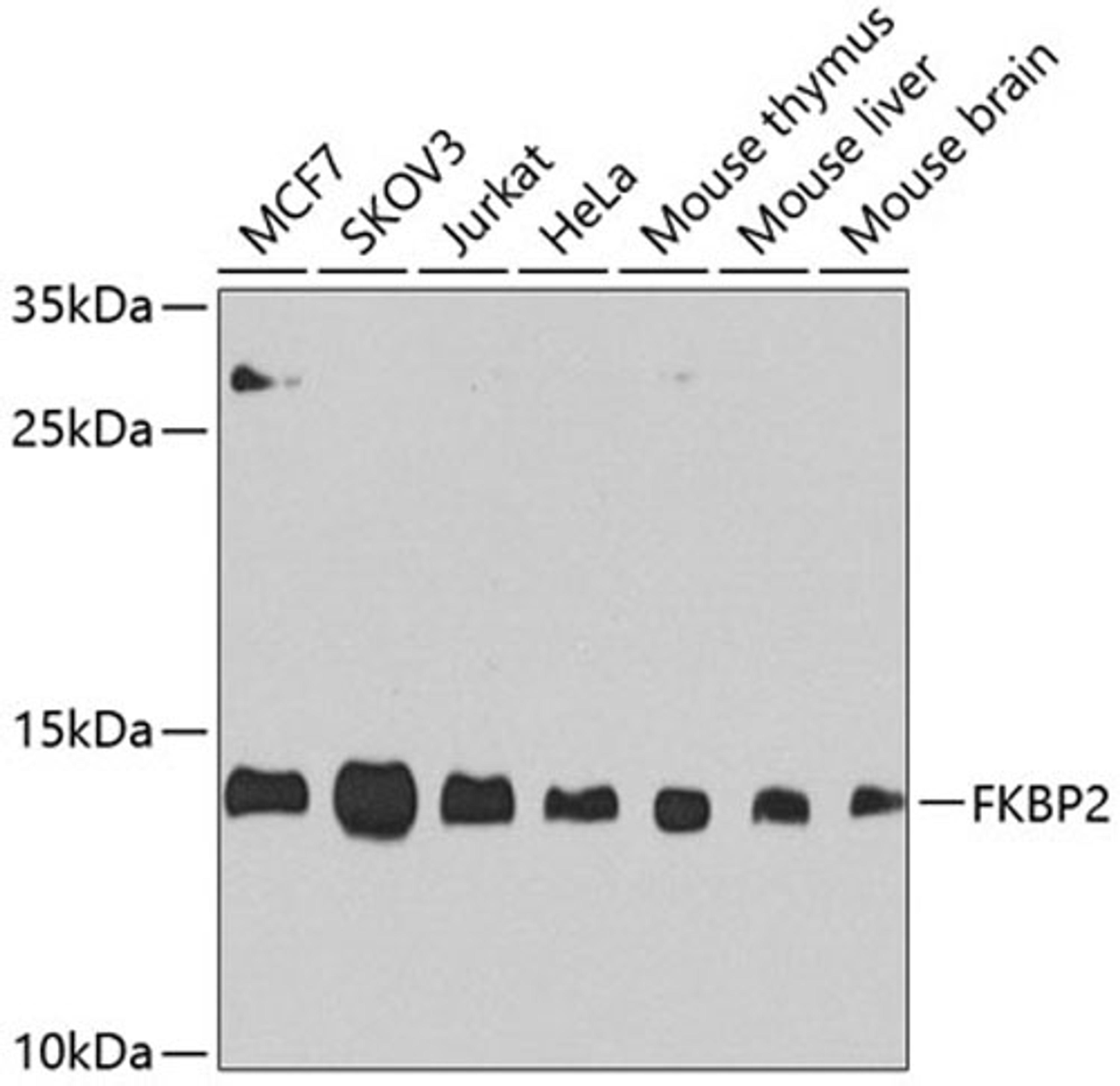 Western blot - FKBP2 antibody (A8120)