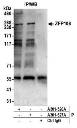 Detection of human ZFP106 by western blot of immunoprecipitates.