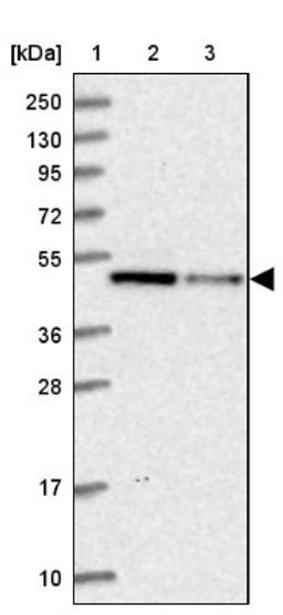 Western Blot: IST1 Antibody [NBP1-87676] - Lane 1: Marker [kDa] 250, 130, 95, 72, 55, 36, 28, 17, 10<br/>Lane 2: Human cell line RT-4<br/>Lane 3: Human cell line U-251MG sp