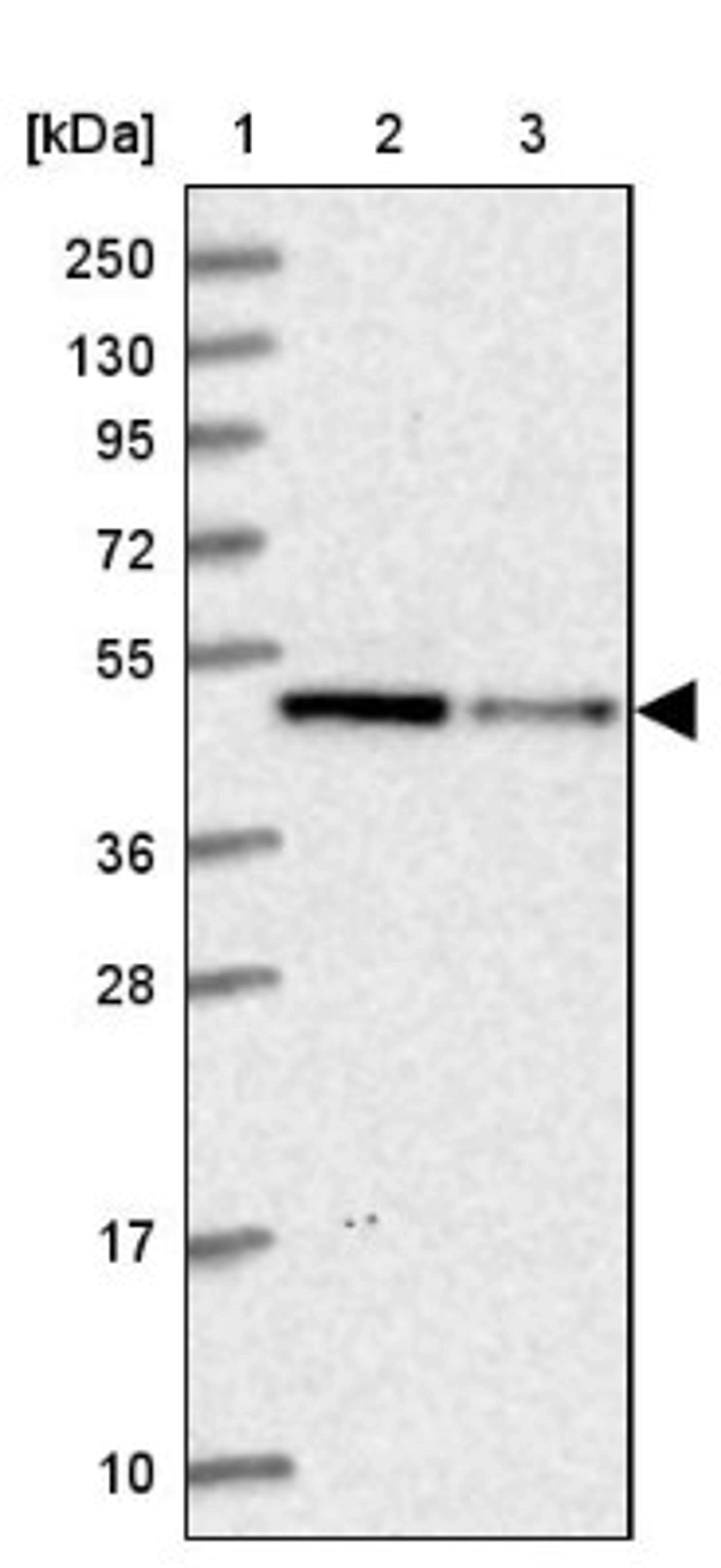 Western Blot: IST1 Antibody [NBP1-87676] - Lane 1: Marker [kDa] 250, 130, 95, 72, 55, 36, 28, 17, 10<br/>Lane 2: Human cell line RT-4<br/>Lane 3: Human cell line U-251MG sp