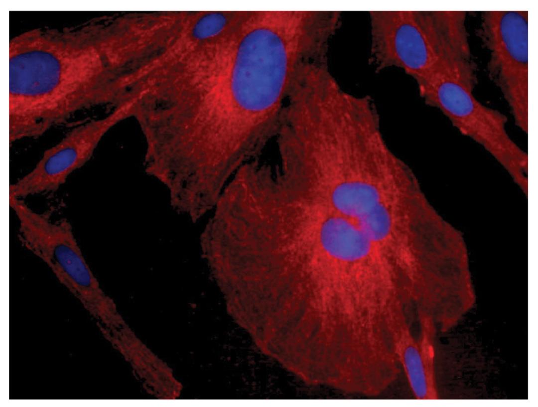 Human astrocytoma cell line CCF-STTG1 was stained with Mouse Anti-Human GFAP-CY3 (Cat. No. 99-782).