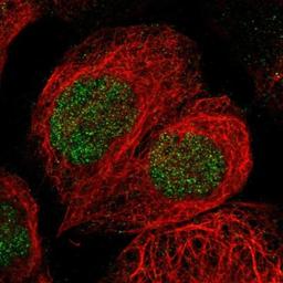 Immunocytochemistry/Immunofluorescence: ACTL7A Antibody [NBP1-86014] - Immunofluorescent staining of human cell line A-431 shows positivity in nucleus.