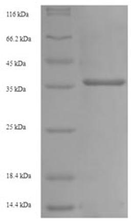 (Tris-Glycine gel) Discontinuous SDS-PAGE (reduced) with 5% enrichment gel and 15% separation gel.