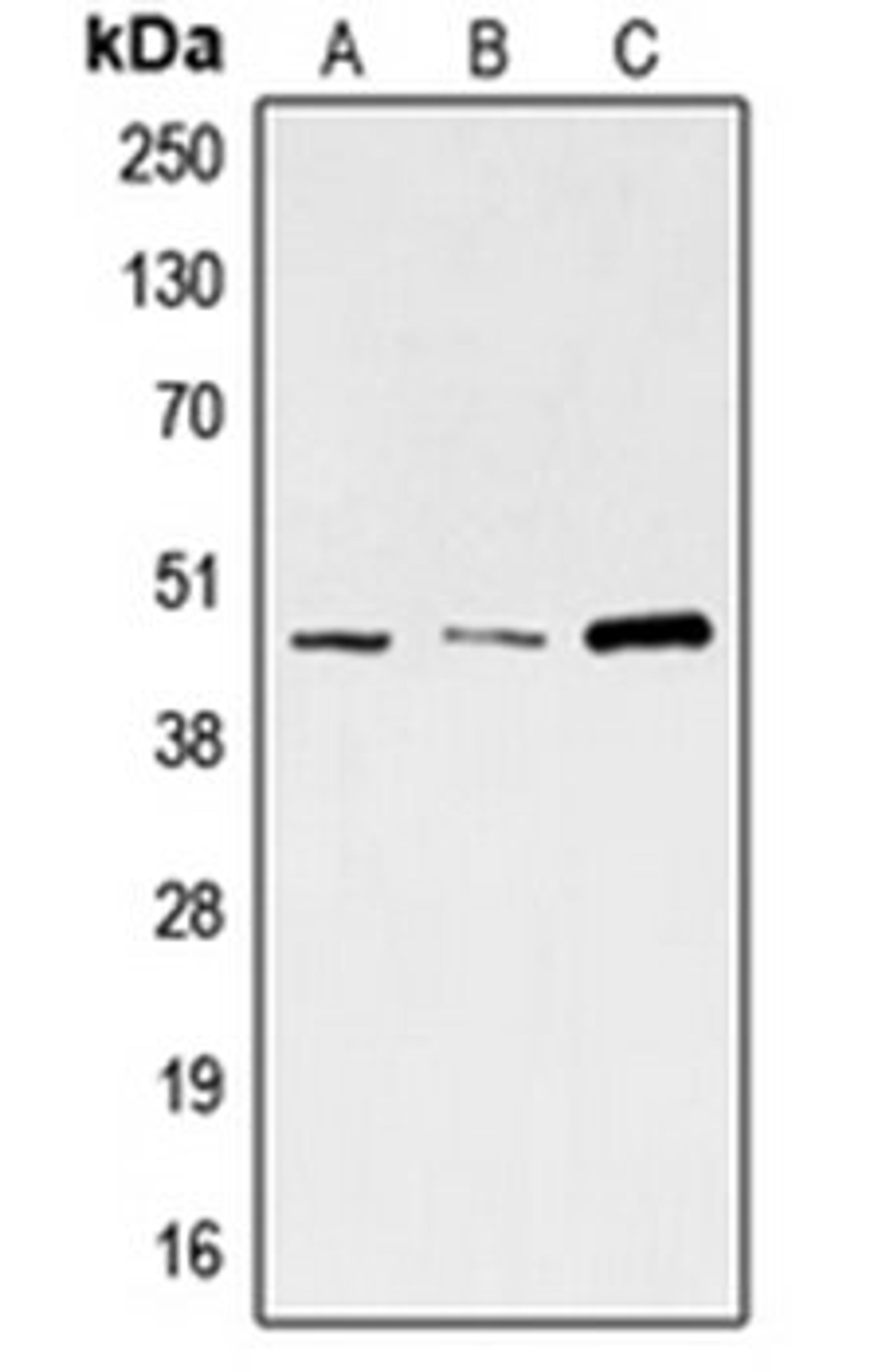 Western blot analysis of A673 (Lane 1), HeLa (Lane 2), K562 (Lane 3) whole cell lysates using SKP2 antibody