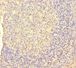 Immunohistochemistry of paraffin-embedded human tonsil tissue using CSB-PA06859A0Rb at dilution of 1:100