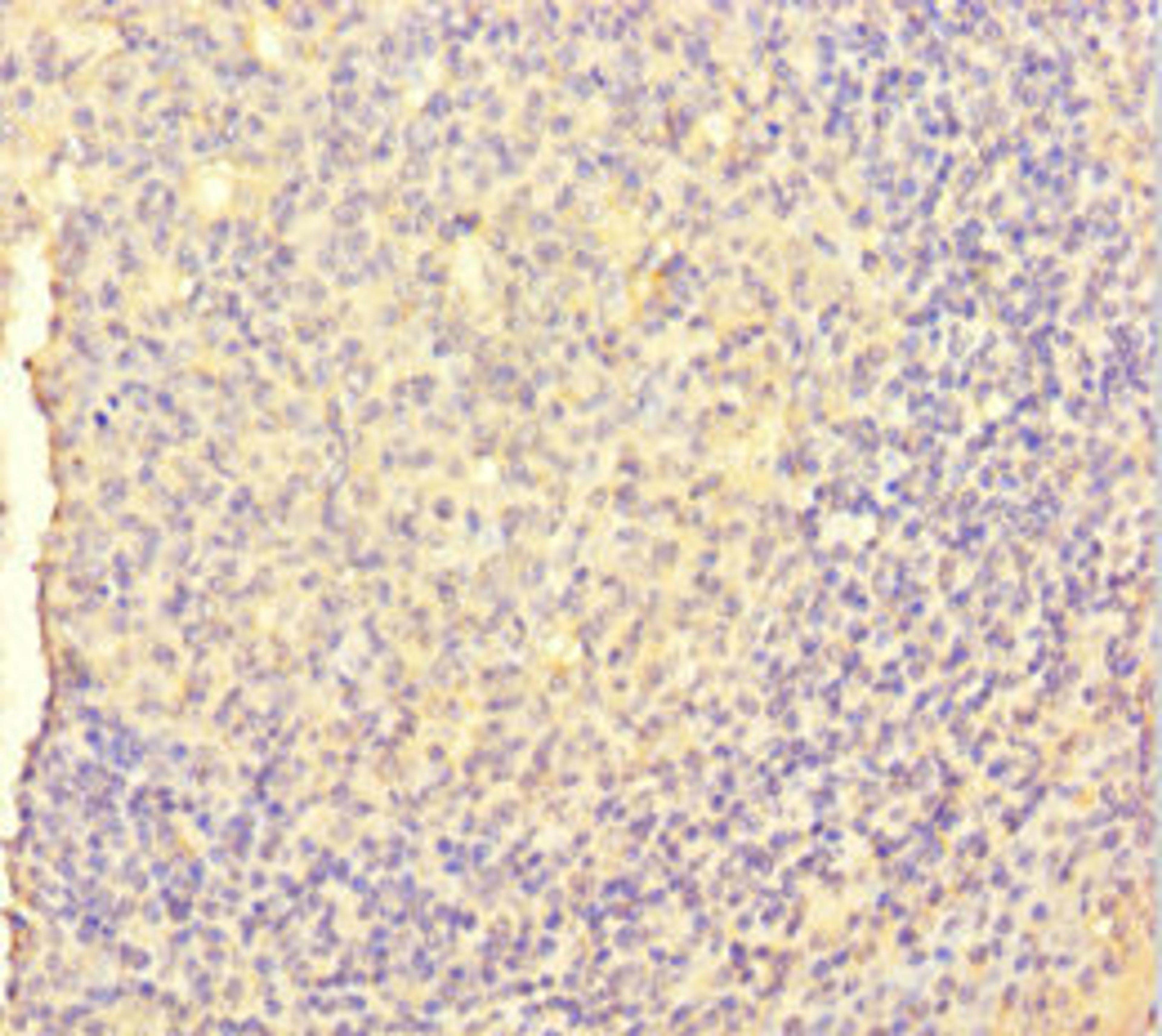 Immunohistochemistry of paraffin-embedded human tonsil tissue using CSB-PA06859A0Rb at dilution of 1:100