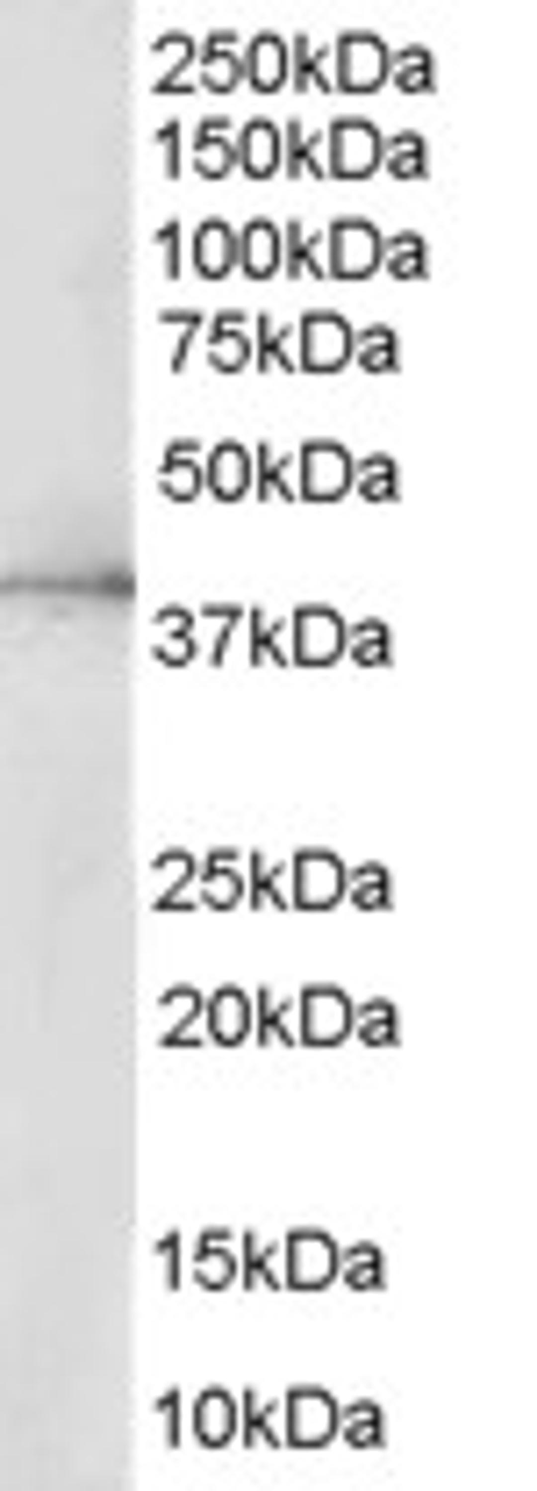 45-551 (0.5ug/ml) staining of HepG2 lysate (35ug protein in RIPA buffer). Primary incubation was 1 hour. Detected by chemiluminescence.